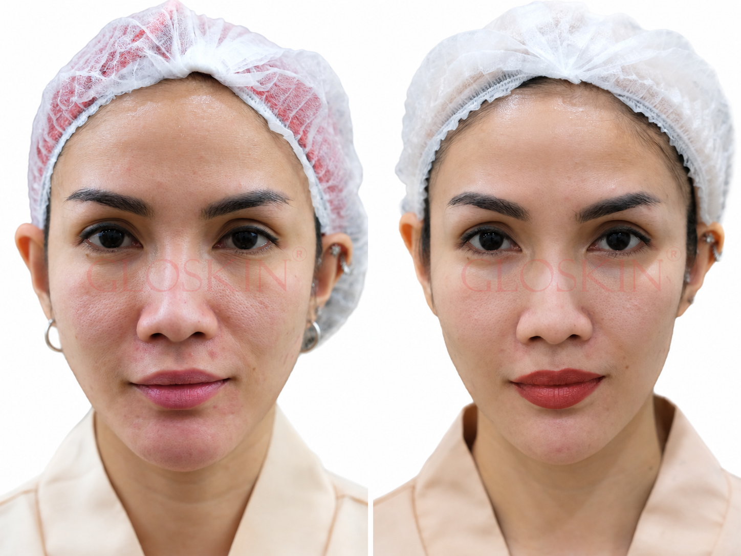 Juvelook - Gambar 4