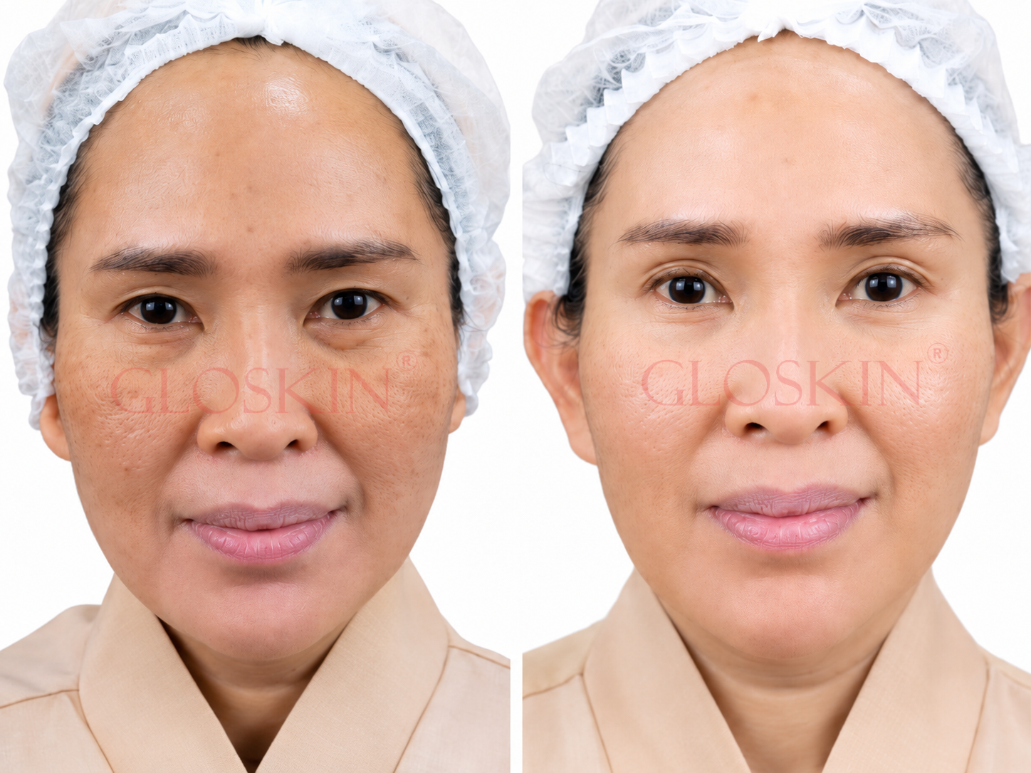 Xelarederm - Gambar 2
