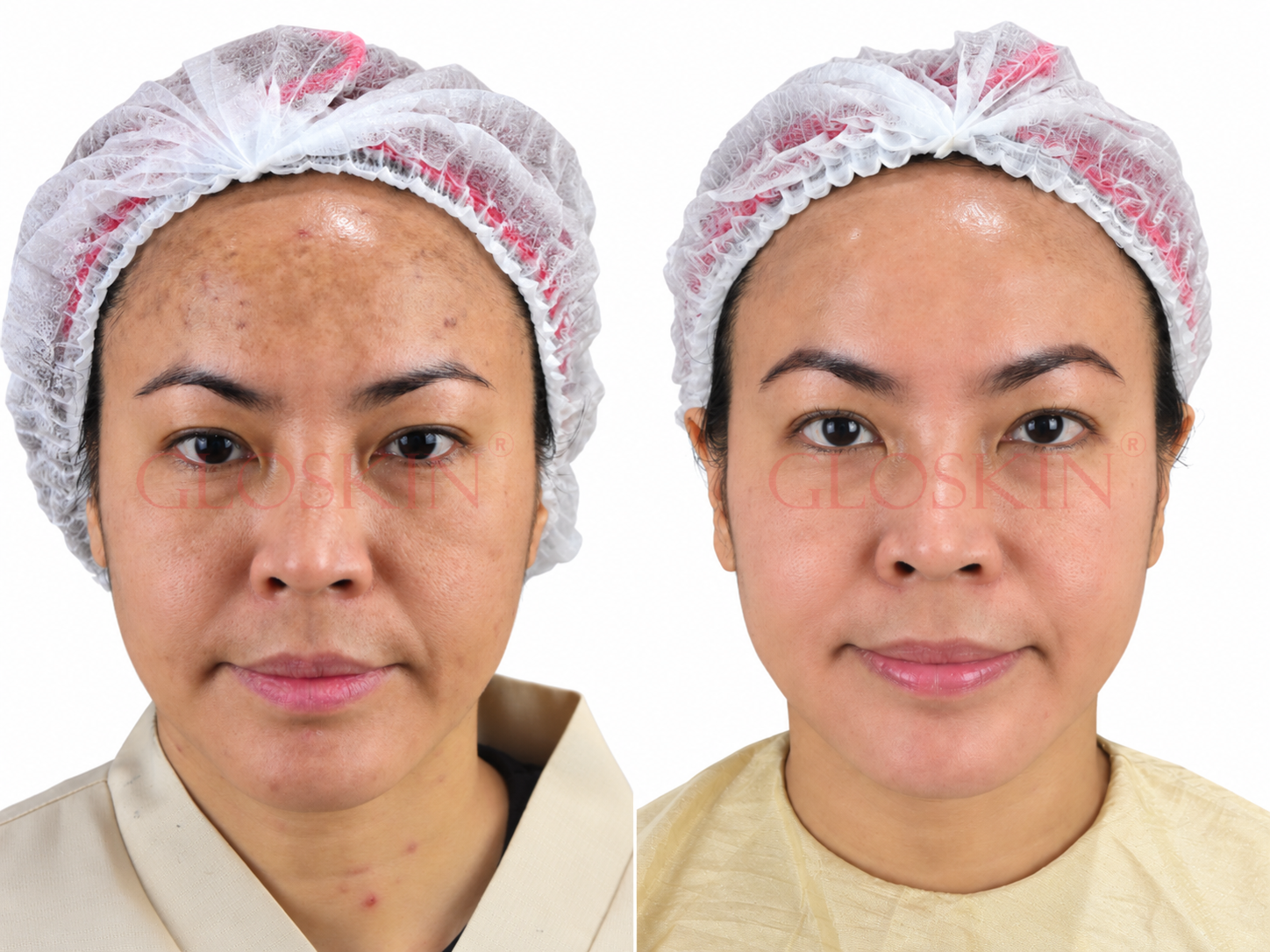 Xelarederm - Gambar 3