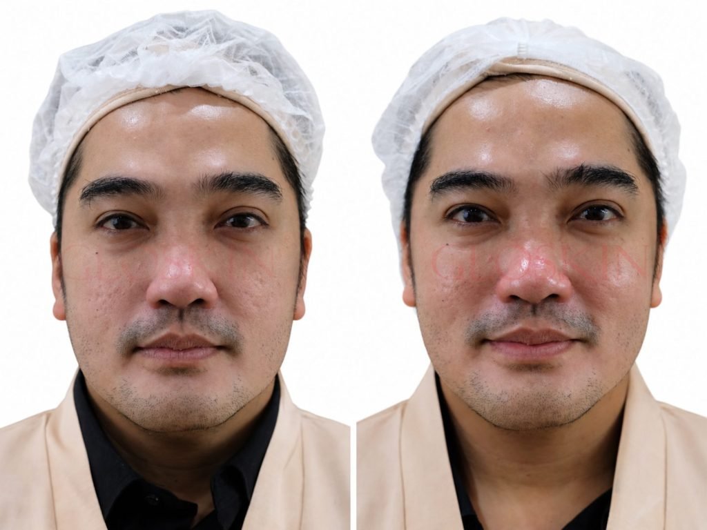 Luxury Facial Therapy