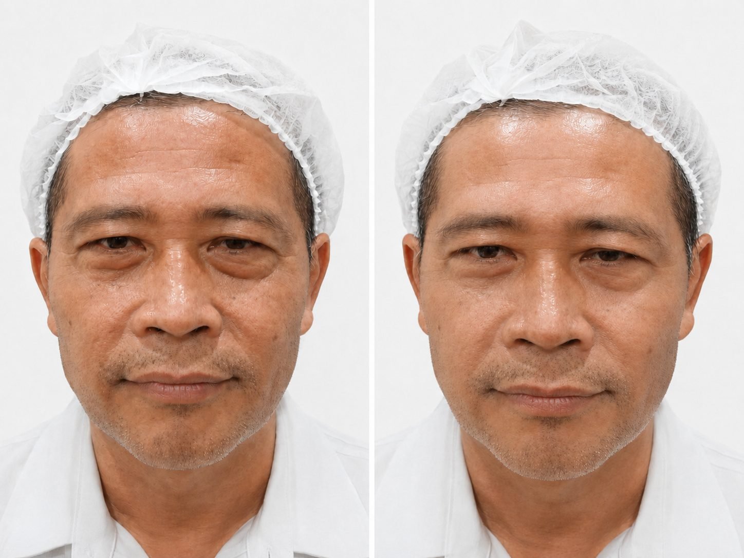 Sculpt Lymphatic Facial Therapy
