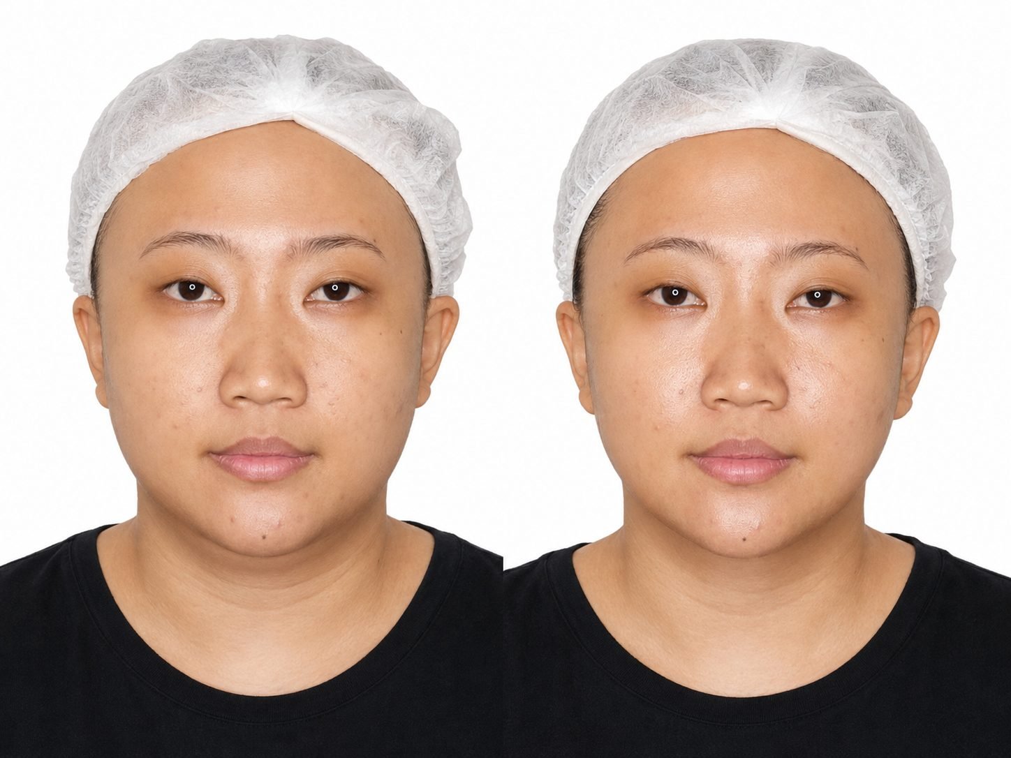 Sculpt Lymphatic Facial Therapy